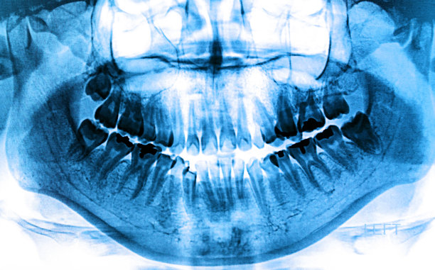 照片x射线扫描人体图片下载