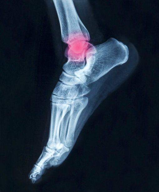 电影x光脚图片下载