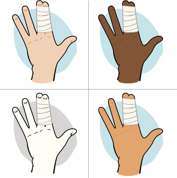 用绷带包扎手指进行急救图片下载