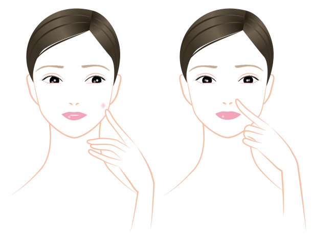 斑点，皮疹，鼻翼毛孔，中年妇女图片下载