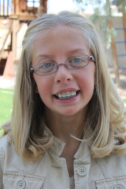 穿着夹克微笑的小女孩图片下载