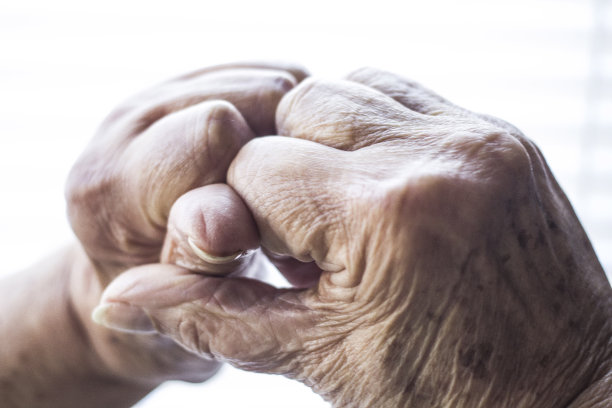 老年妇女的手有风湿病图片下载