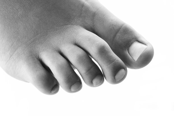 足部美容黑白治疗图片下载