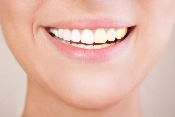 牙齿美白前后。图片下载