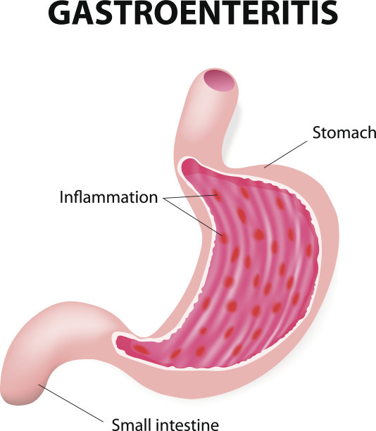 胃病毒图片下载