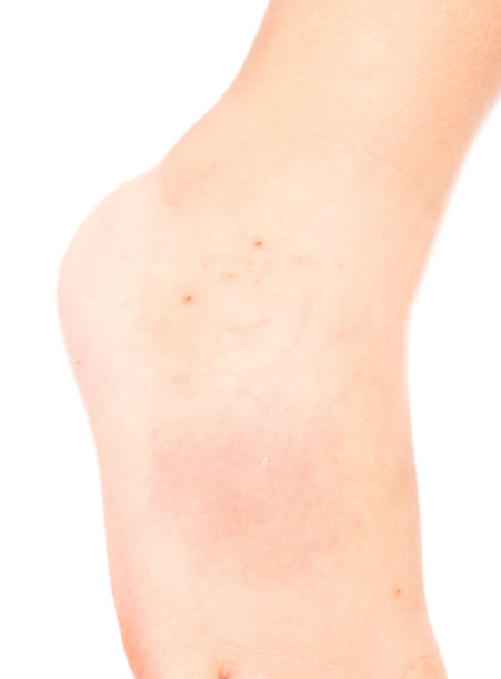 宝宝的腿图片下载