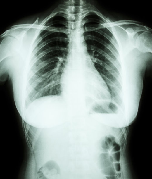 x光亚洲女性(泰国人)图片下载