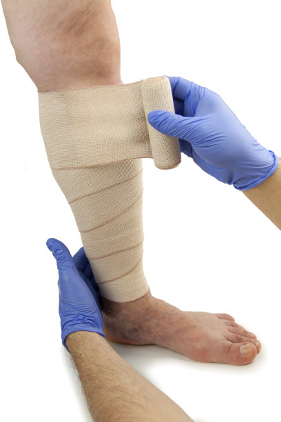 静脉曲张和绷带图片下载