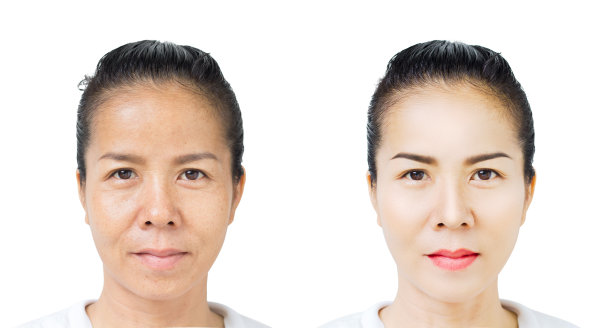 美丽的亚洲女人的脸之前和之后的修饰图片下载