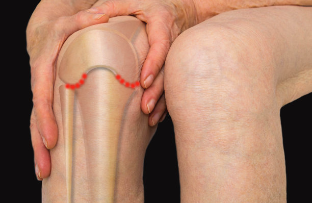 老妇人抱着膝盖，疼痛难忍素材图片