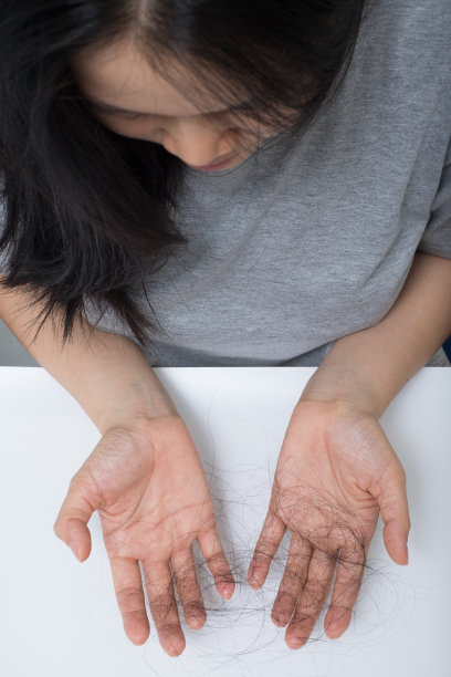 女性脱发问题图片下载