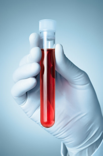 手拿血样图片下载