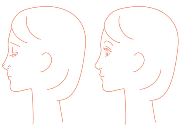 鼻子，角蛋白堵塞，毛孔，皮脂，黑头图片下载