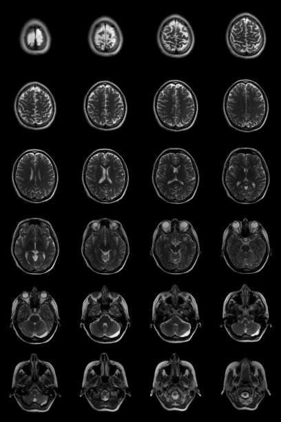 核磁共振扫描的人类大脑图片下载
