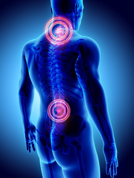 骶部和颈部疼痛的三维图示。素材图片