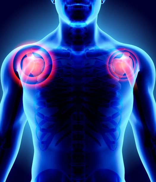 肩部疼痛的3D插图。图片下载