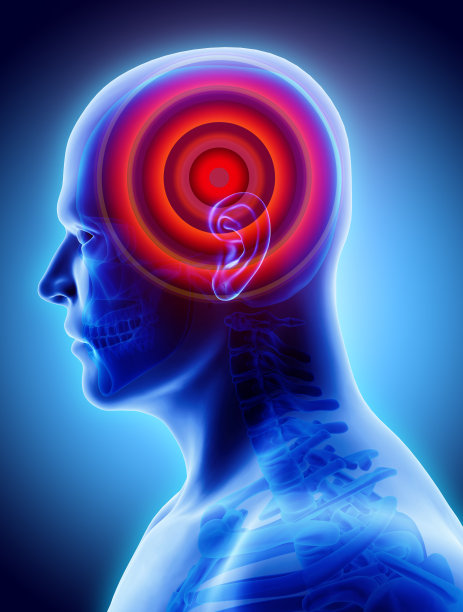 头痛信号，医学概念。图片下载