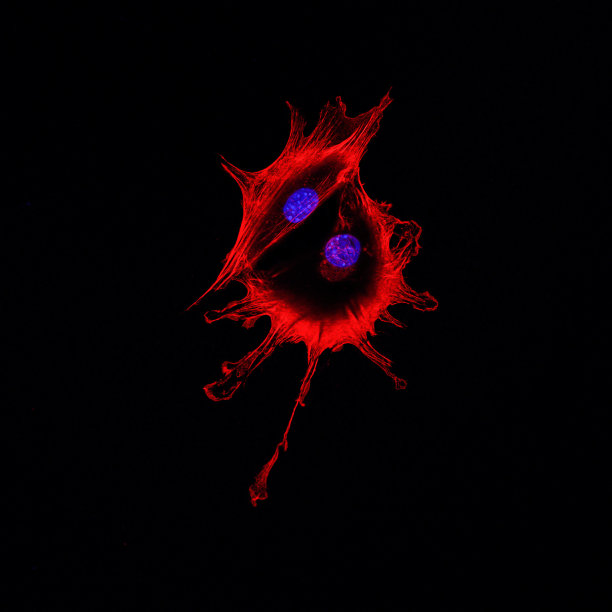 两个癌细胞移动的共聚焦显微镜成像图片下载