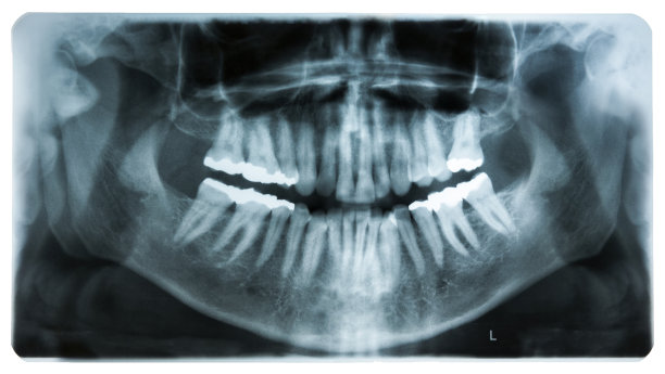 口腔x光片图片下载