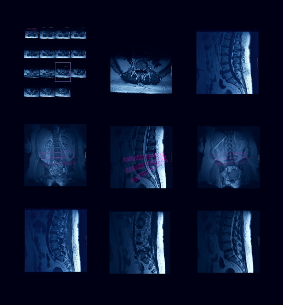 磁共振系列II图片下载