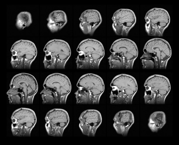 磁共振成像(MRI)图片下载