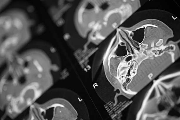 人头骨X光片图片下载
