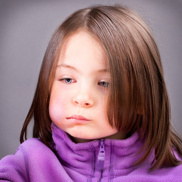 黑眼睛和淤青脸颊担心女孩图片下载