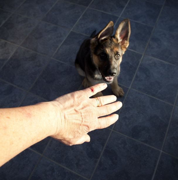 手被小狗咬伤图片下载