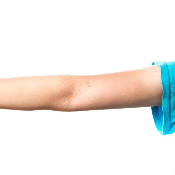 手上有湿疹皮肤图片下载