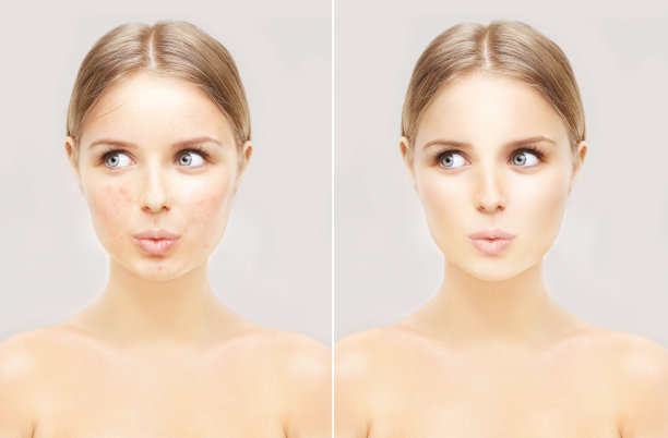 有问题的女孩和干净的皮肤。图片下载