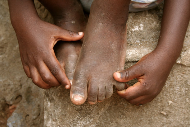 非洲儿童的手和脚图片下载