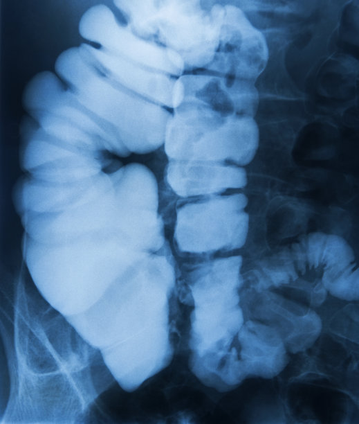 人类的胃图片下载