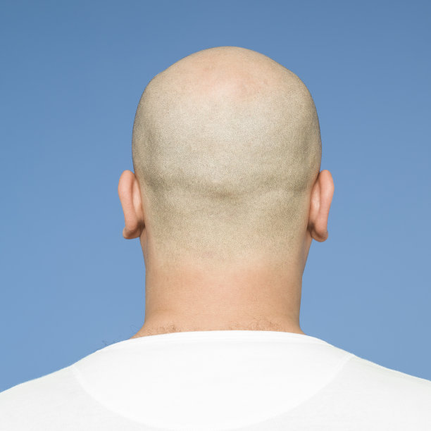 光头的后视图图片下载