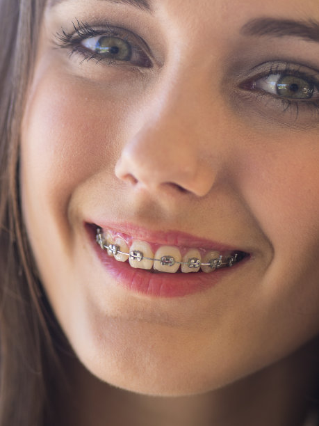 夫人用括号图片下载