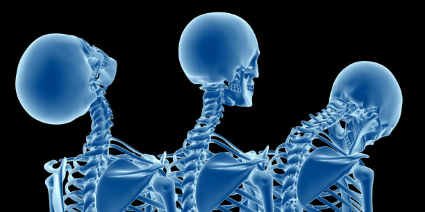 人体解剖，显示颈部损伤，如颈部鞭伤图片下载