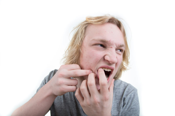 挤压粉刺图片下载