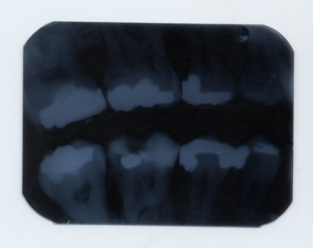 牙科记录图片下载