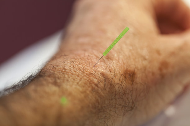 针灸。照明针图片下载