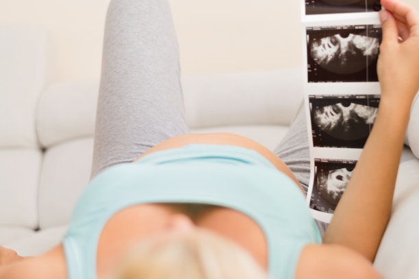 孕妇看超声波扫描图片下载