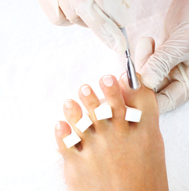 专业的修脚治疗。图片下载