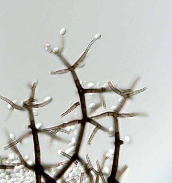 一种未知真菌的分生孢子图片下载