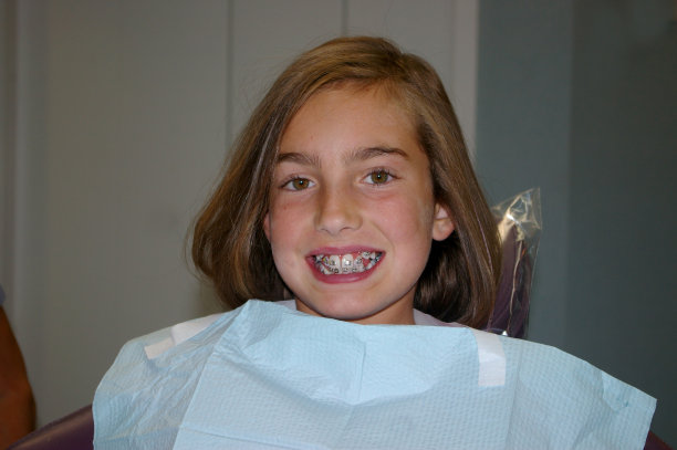 牙齿上有牙托的小女孩图片下载