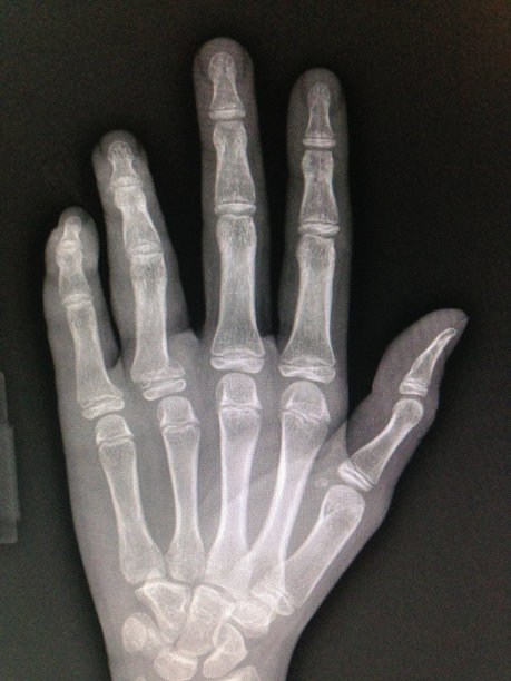 手x射线图片下载
