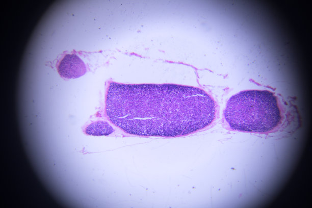显微镜下的神经干横截面图片下载