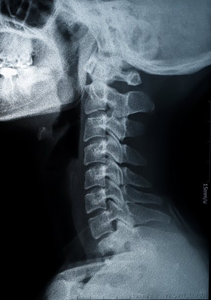 x射线图像图片下载