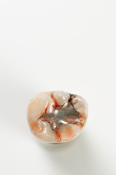 提取的牙齿图片下载