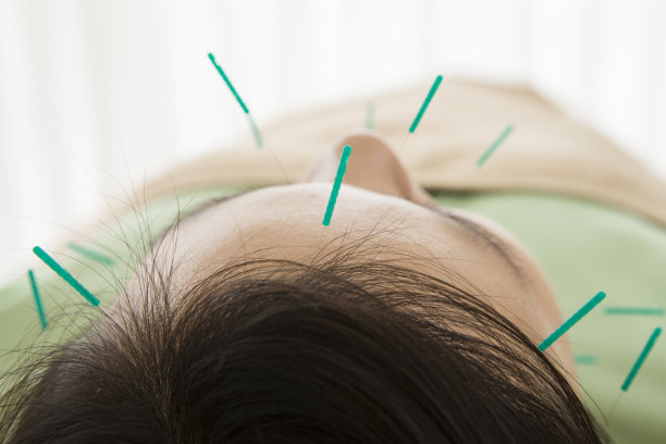 接受面部针灸治疗的妇女图片下载