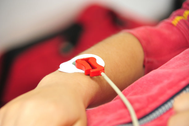 人手臂的心电图图片下载