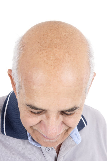 秃头的高级人图片下载