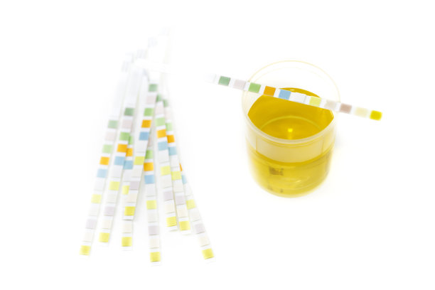 尿液测试套件图片下载